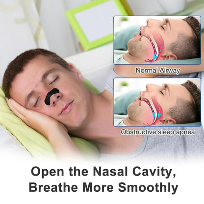 Nasal Strips by miori